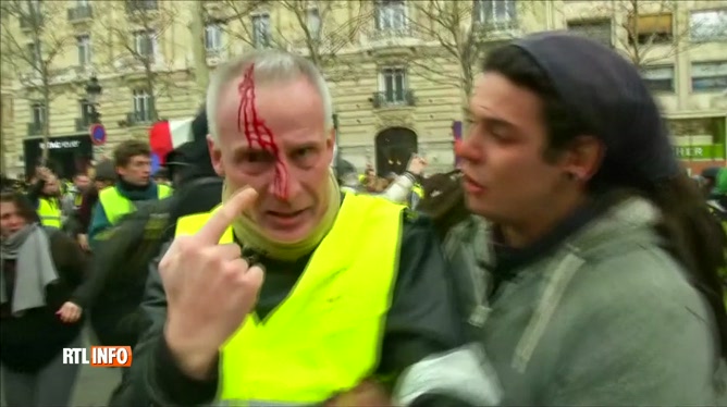 Main Arrachée Dun Gilet Jaune à Paris Le Père De La